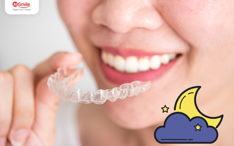 Niềng răng trong suốt ban đêm là phương pháp chỉnh nha chỉ yêu cầu đeo khay từ 8-10 tiếng mỗi khi ngủ, giúp bạn tự do hoàn toàn vào ban ngày