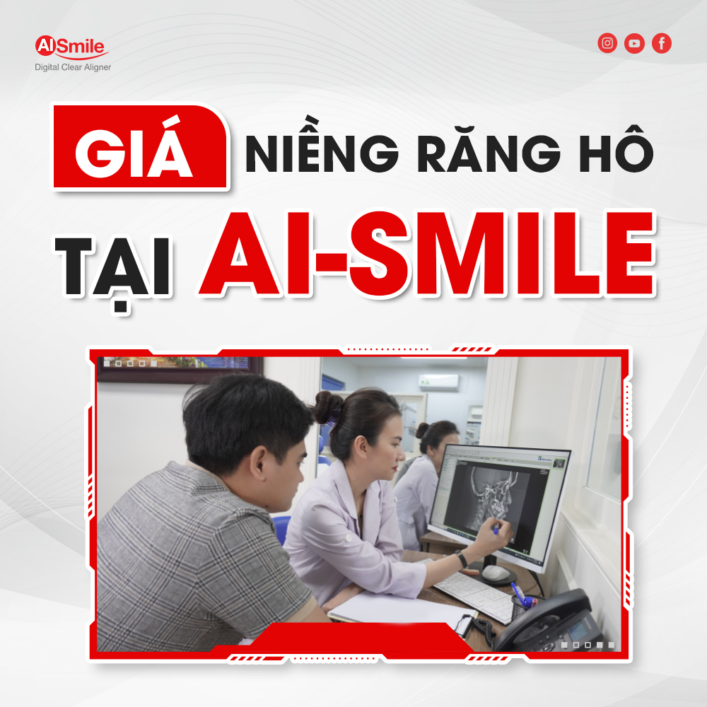 Giá niềng răng hô tại AI Smile